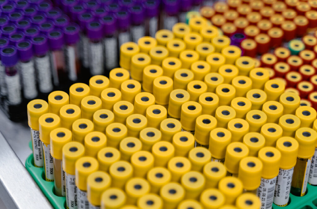 Homo sapiens isolate H1470 BCR/ABL variant p190 fusion protein mRNA, partial cds (PZ330002)