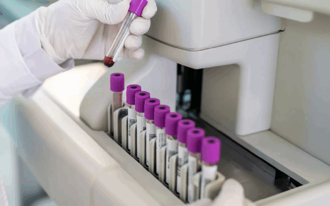 Homo sapiens PML-RARalpha fusion protein mRNA, partial cds (MH401091)