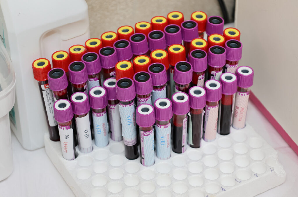 Homo sapiens voucher H749.1 H749.1PML-RARa fusion protein mRNA, partial cds (PZ349583)